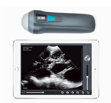 Wireless Probe Ultrasound Scanner