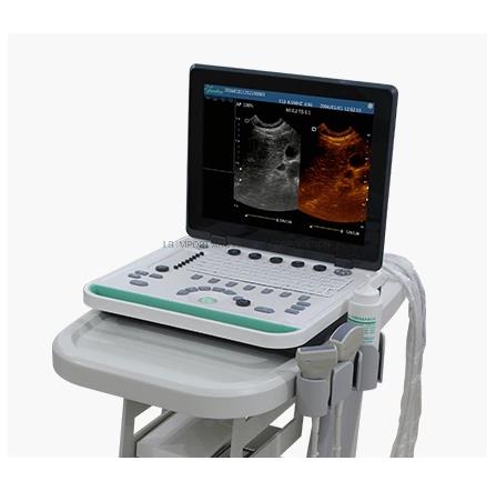 LG-SS-9 PC Based Laptop Ultrasound B Scanner(Ultrasound Ultrasonic Scanner)