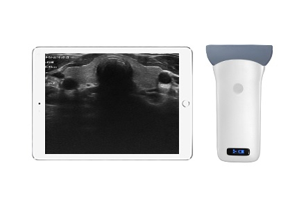 Super Width Linear Probe Type Wireless Mini Ultrasound Scanner